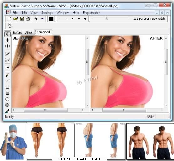 virtual plastic surgery software 1.0.0.1484 the vpss simple use, yet powerful photo warping software